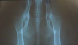 Heros-hip-x-rays-May-2008-250x145.jpg