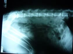 spine-xray-10-14-10-250x187.jpg