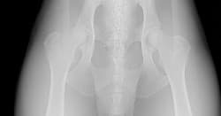 Imo_Kohl_Pelvis-Pelvis-Ex-250x131.jpg